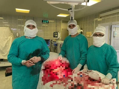 В Уфе врачи удалили гигантскую опухоль у 200-килограммового пациента