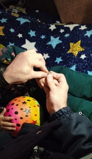 В Уфе спасли пальчик трёхлетней девочки от импровизированного колечка