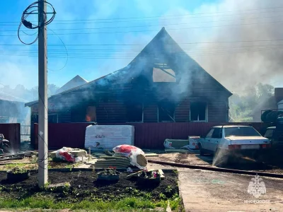 Под Уфой при пожаре в доме мужчина получил жуткие ожоги